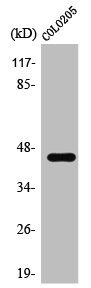 SSB antibody