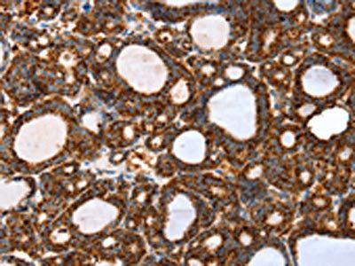 SSBP1 Antibody