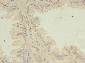 ITPRID2 Antibody