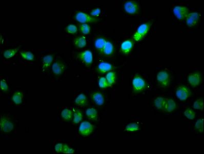 SSH1 Antibody