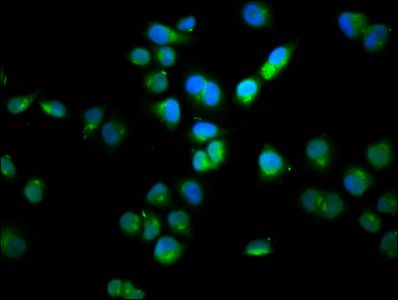 SSH1 antibody