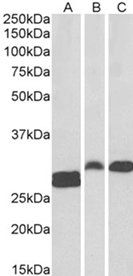 Goat anti-SSP29 / ANP32B Antibody