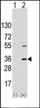 SSR1 antibody