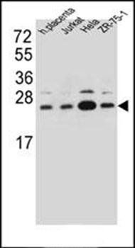 SSR2 antibody