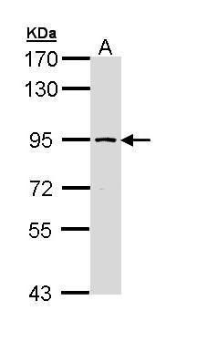SSRP1 antibody