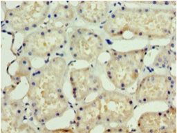 SSSCA1 Antibody