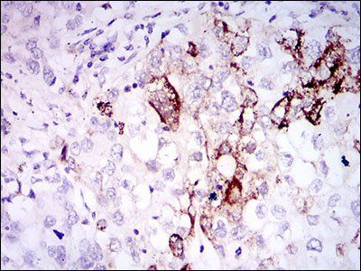 SST Antibody