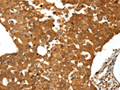 SSTR1 Antibody