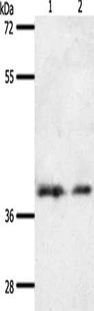 SSTR1 antibody