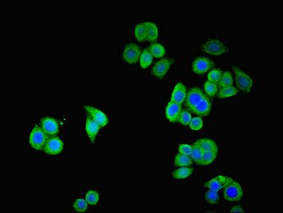 SSTR2 Antibody