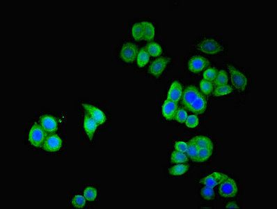 SSTR2 antibody