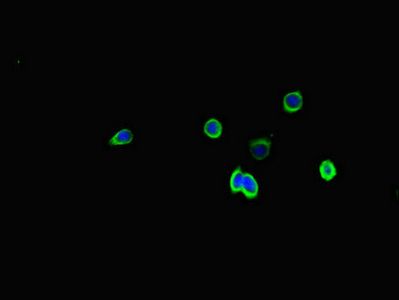 SSTR2 antibody