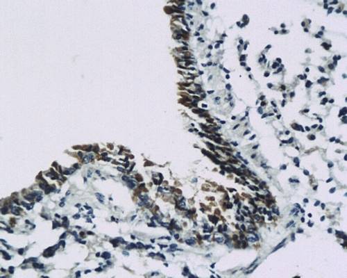 Somatostatin Receptor 2 Rabbit Polyclonal Antibody