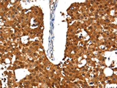 SSTR5 Antibody