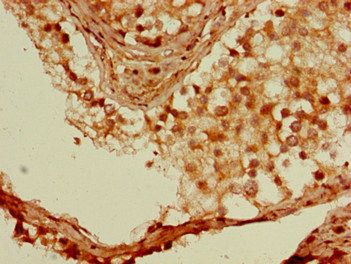 SSX1 Antibody