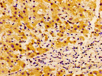 SSX2IP Antibody