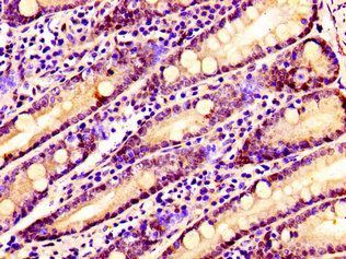 SSX2IP Antibody