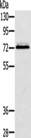 SSX2IP antibody