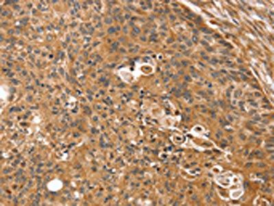 SSX2IP Antibody