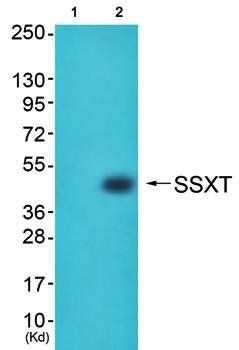 SSXT antibody