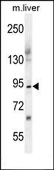 ST14 antibody