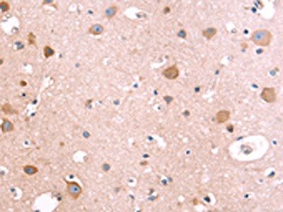 IL1RL1 Antibody