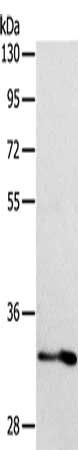 ST2 antibody