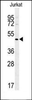 ST3GAL5 antibody