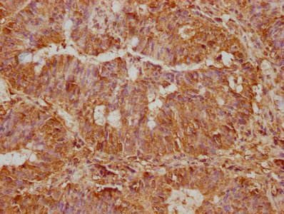 ST5 Antibody
