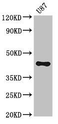 ST8SIA5 Antibody