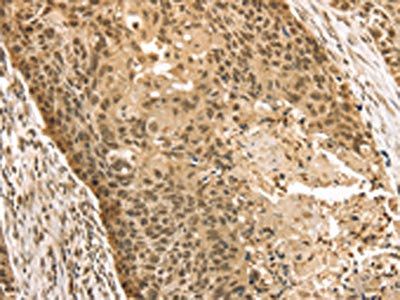 STAG2 Antibody