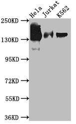 STAG2 Recombinant Monoclonal Antibody