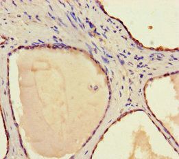 STAM-binding protein antibody