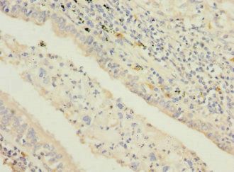 STAM2 Antibody