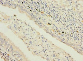 STAM2 antibody