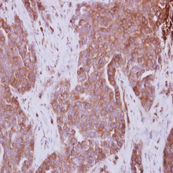 STAM antibody
