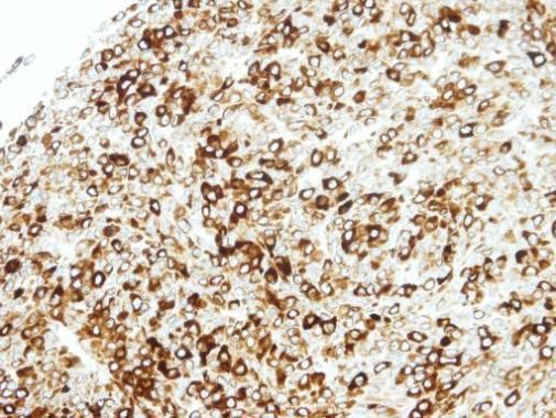 signal transducing adaptor family member 2 Antibody