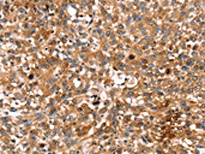 STAR Antibody