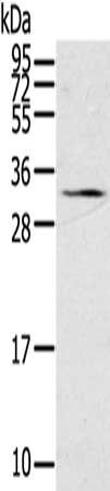 STAR Antibody