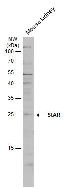 steroidogenic acute regulatory protein Antibody