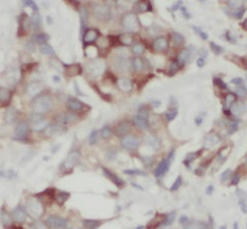 STARD3NL antibody