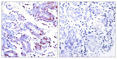 STAT1 (Ab-701) Antibody