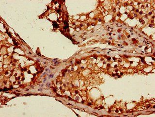 STAT1 Antibody