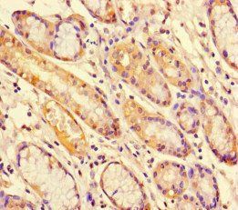 STAT1 Antibody