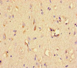 STAT1 Antibody