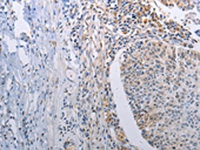STAT1 Antibody