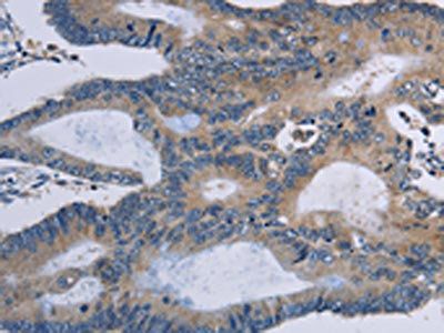 STAT1 Antibody