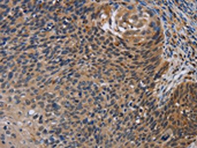STAT1 Antibody