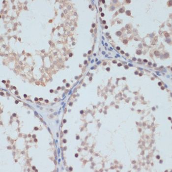 STAT1 (Phospho-S727) antibody