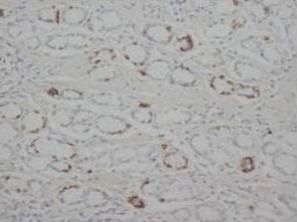 STAT1 Antibody